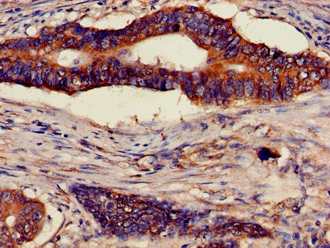 ATP5D Antibody in Immunohistochemistry (Paraffin) (IHC (P))