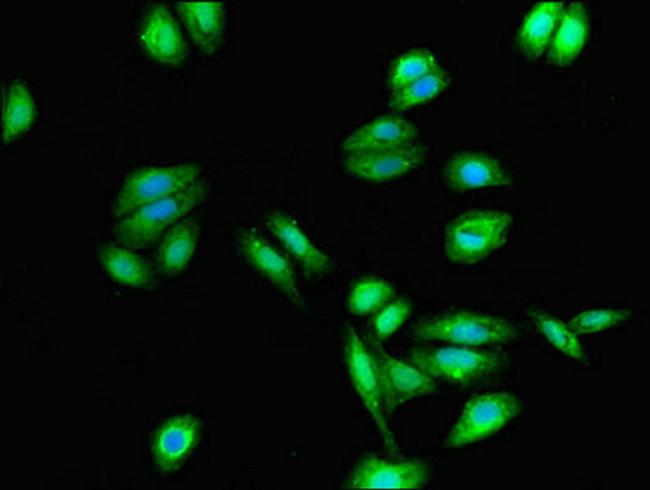 CYSLTR1 Antibody in Immunocytochemistry (ICC/IF)