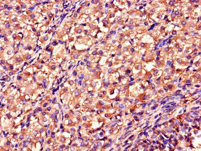 DDAH2 Antibody in Immunohistochemistry (Paraffin) (IHC (P))