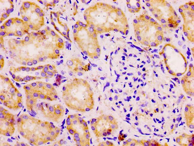 DLD Antibody in Immunohistochemistry (Paraffin) (IHC (P))