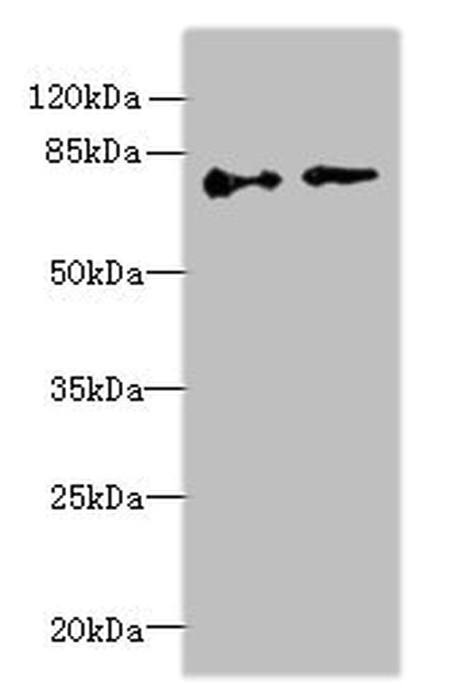 ECD Antibody in Western Blot (WB)