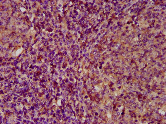 ECM1 Antibody in Immunohistochemistry (Paraffin) (IHC (P))