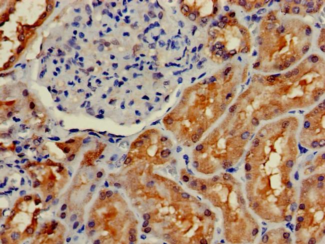 EPHX2 Antibody in Immunohistochemistry (Paraffin) (IHC (P))