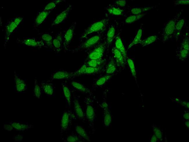 ESRP2 Antibody in Immunocytochemistry (ICC/IF)