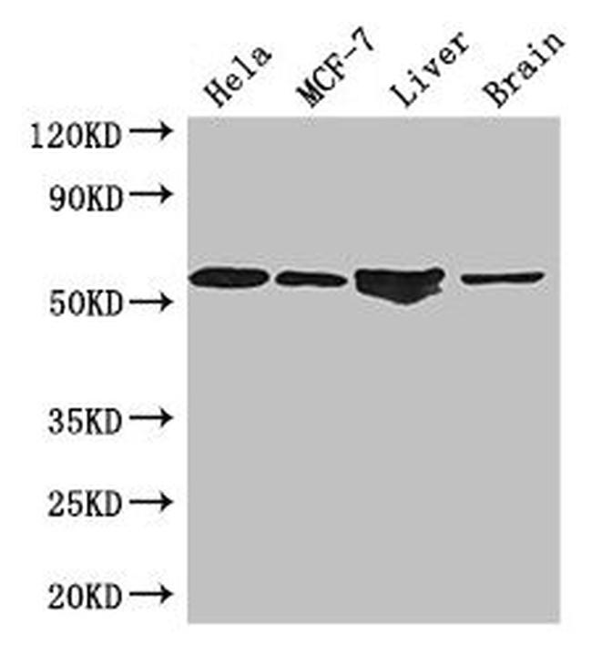 ETS2 Antibody in Western Blot (WB)