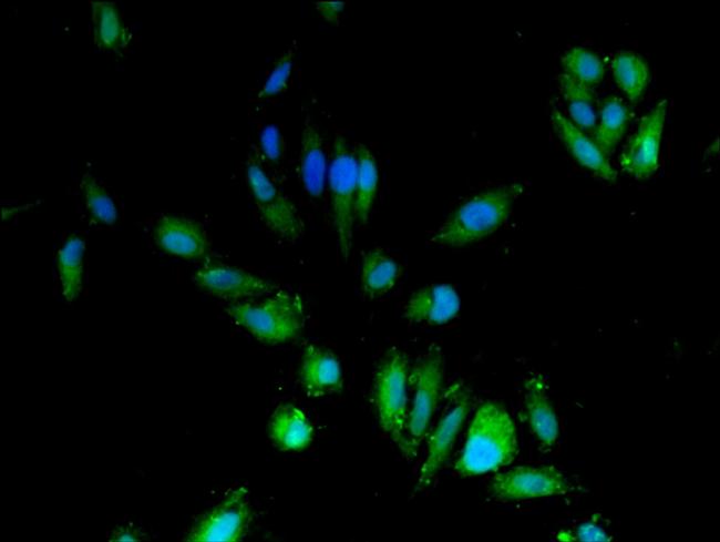 CDA Antibody in Immunocytochemistry (ICC/IF)