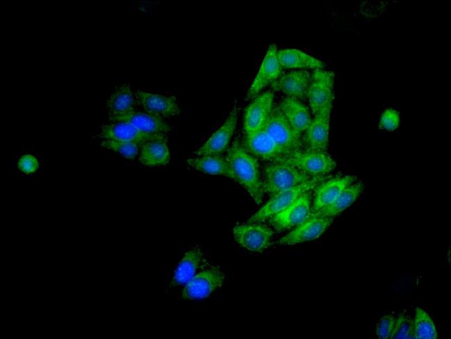 FDFT1 Antibody in Immunocytochemistry (ICC/IF)