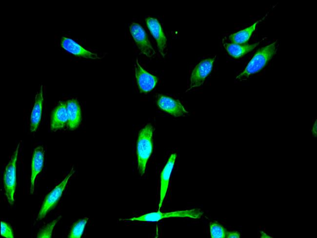 FGFR1 Antibody in Immunocytochemistry (ICC/IF)