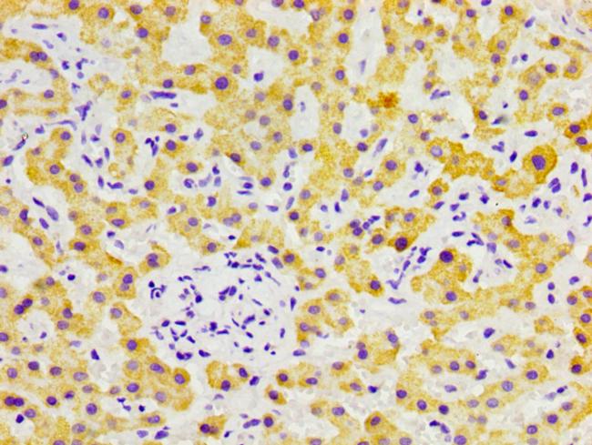 FGL1 Antibody in Immunohistochemistry (Paraffin) (IHC (P))