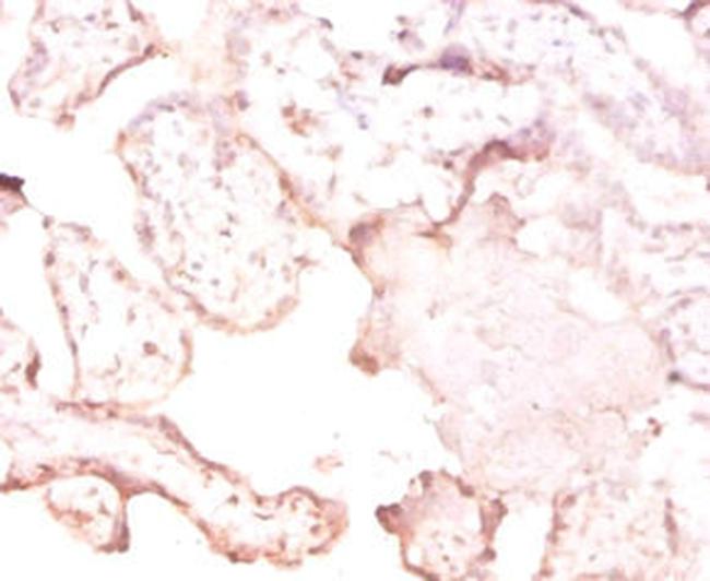 FTSJ1 Antibody in Immunohistochemistry (Paraffin) (IHC (P))