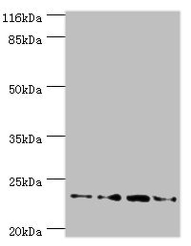 FXN Antibody in Western Blot (WB)