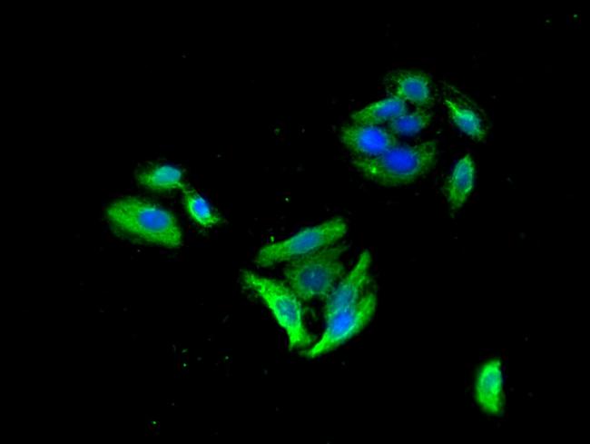 GABRB3 Antibody in Immunocytochemistry (ICC/IF)