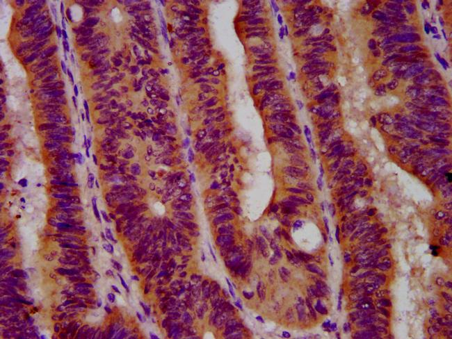 GBA Antibody in Immunohistochemistry (Paraffin) (IHC (P))