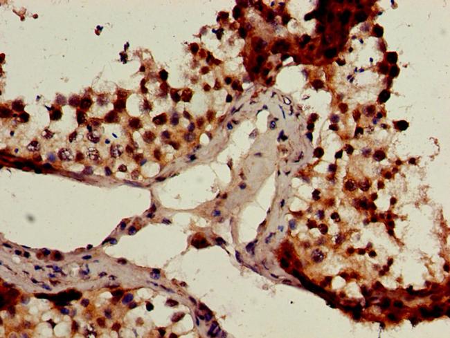 GCM2 Antibody in Immunohistochemistry (Paraffin) (IHC (P))