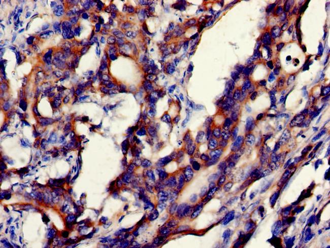 GDI2 Antibody in Immunohistochemistry (Paraffin) (IHC (P))