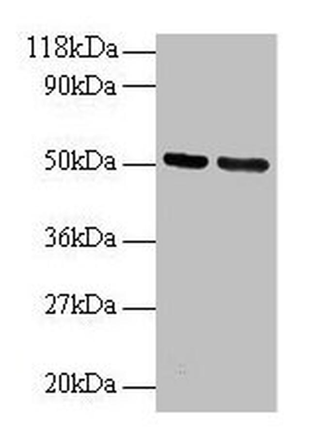 GDI2 Antibody in Western Blot (WB)