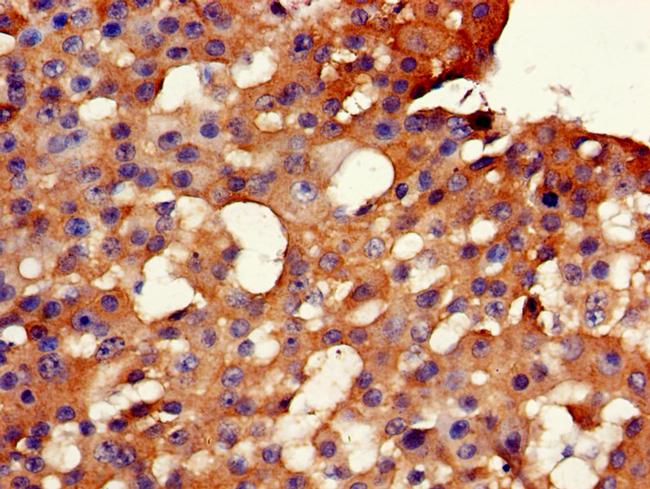 GK2 Antibody in Immunohistochemistry (Paraffin) (IHC (P))