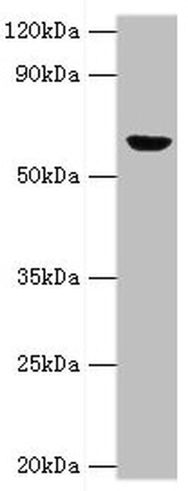 GluD2 Antibody in Western Blot (WB)