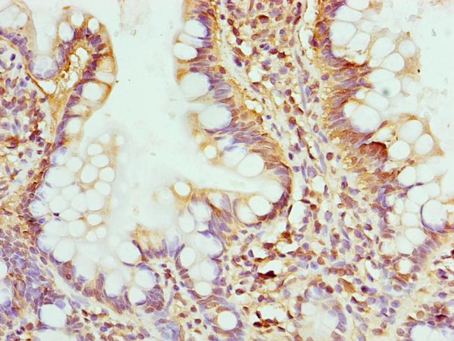 GMPS Antibody in Immunohistochemistry (Paraffin) (IHC (P))