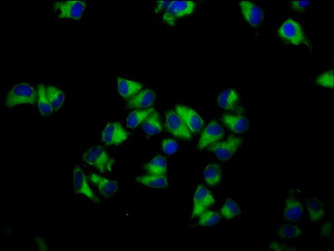 GNA12 Antibody in Immunocytochemistry (ICC/IF)