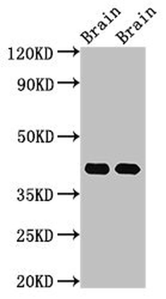 GNAO1 Antibody in Western Blot (WB)