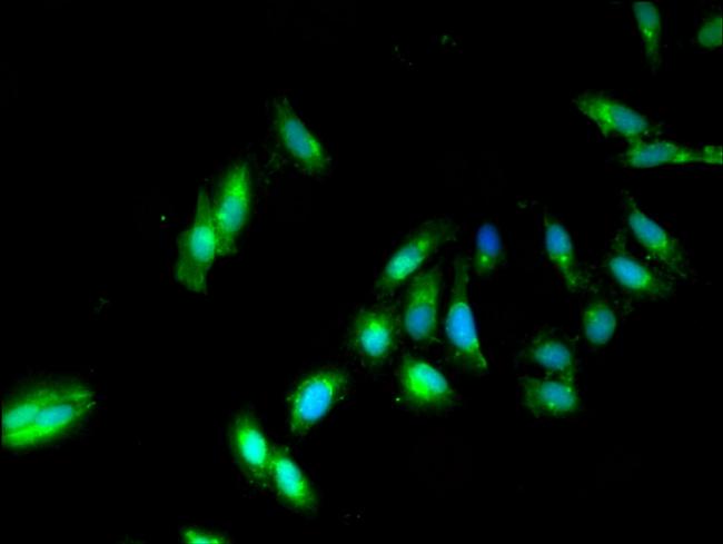 PP2A beta Antibody in Immunocytochemistry (ICC/IF)