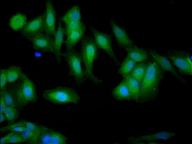 Gelsolin Antibody in Immunocytochemistry (ICC/IF)