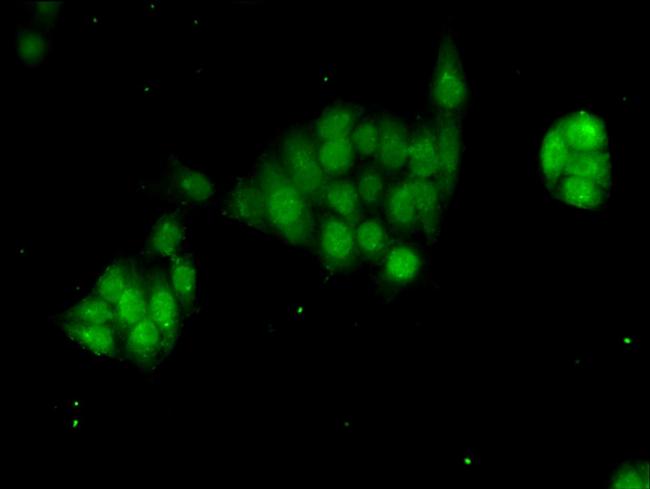 GTF2B Antibody in Immunocytochemistry (ICC/IF)