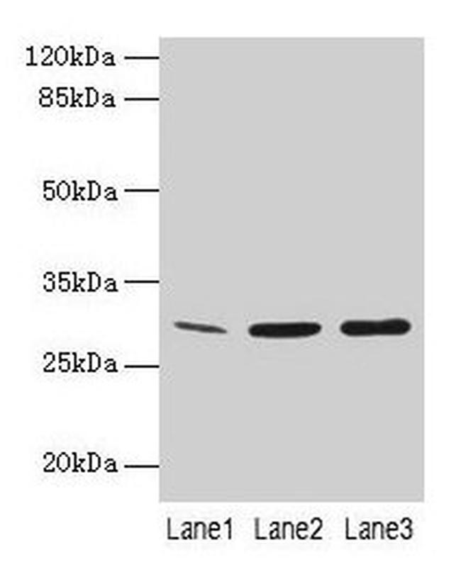 GTF2F2 Antibody in Western Blot (WB)