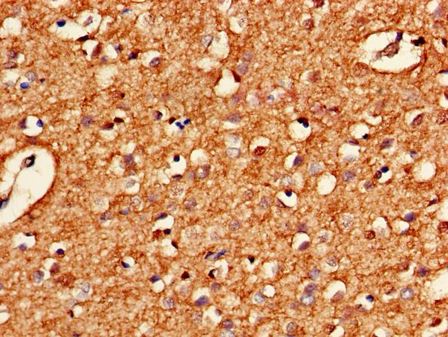 HARS2 Antibody in Immunohistochemistry (Paraffin) (IHC (P))