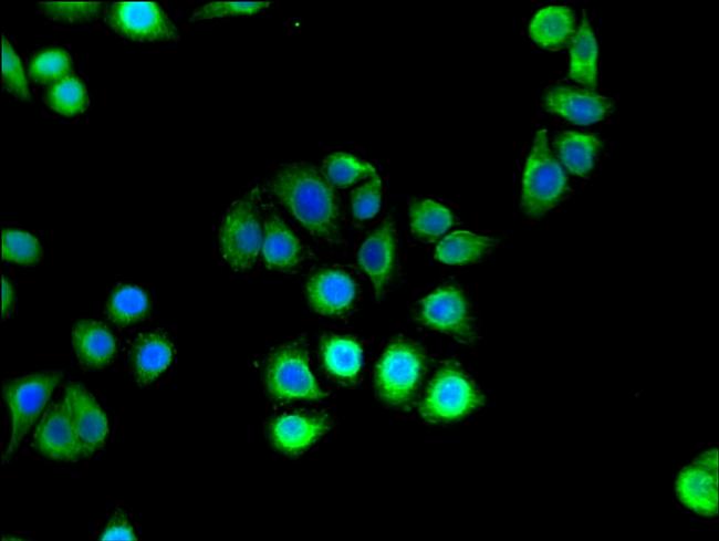 HK2 Antibody in Immunocytochemistry (ICC/IF)