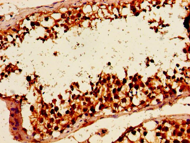 HLTF Antibody in Immunohistochemistry (Paraffin) (IHC (P))