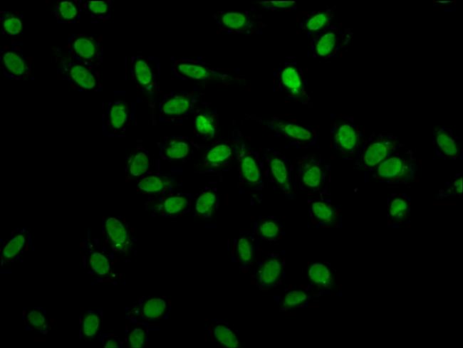 hnRNP A1 Antibody in Immunocytochemistry (ICC/IF)