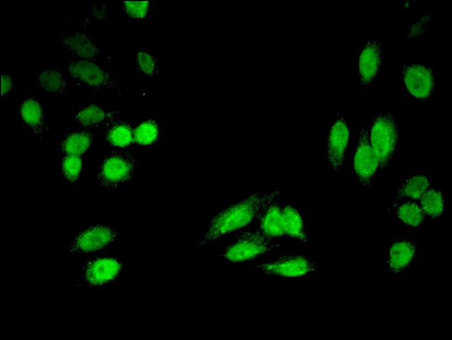 HPD Antibody in Immunocytochemistry (ICC/IF)