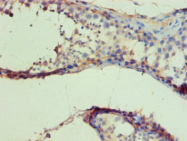 IDH1 Antibody in Immunohistochemistry (Paraffin) (IHC (P))