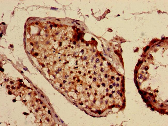 Interferon alpha-10 Antibody in Immunohistochemistry (Paraffin) (IHC (P))