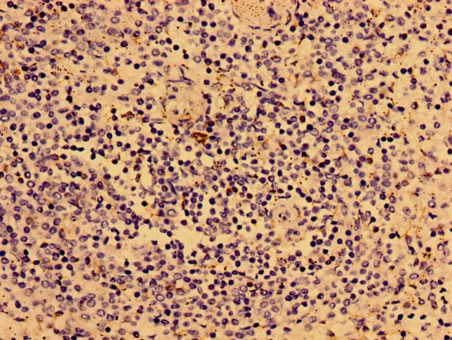 IL2RG Antibody in Immunohistochemistry (Paraffin) (IHC (P))