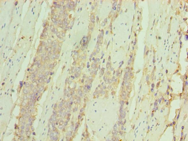 CD127 Antibody in Immunohistochemistry (Paraffin) (IHC (P))