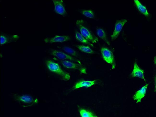 ILVBL Antibody in Immunocytochemistry (ICC/IF)