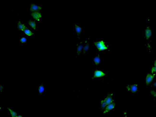 KPNA2 Antibody in Immunocytochemistry (ICC/IF)