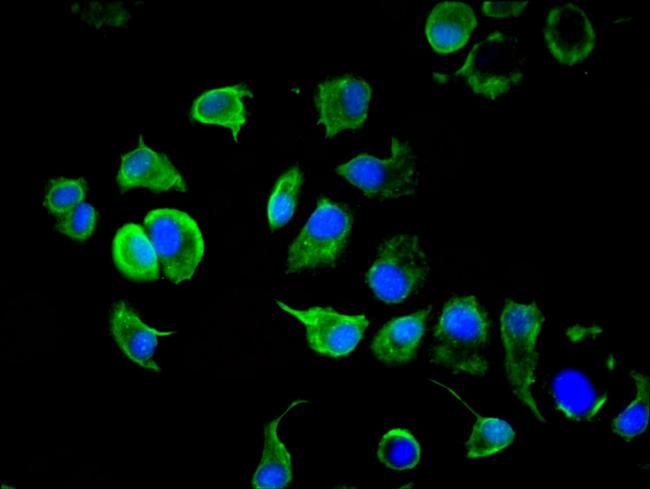 Cytokeratin 10 Antibody in Immunocytochemistry (ICC/IF)