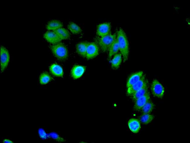 LHR Antibody in Immunocytochemistry (ICC/IF)