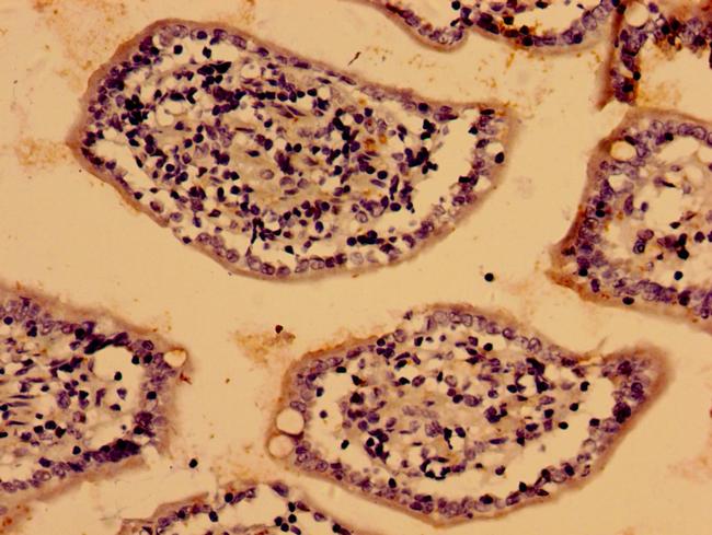 LIAS Antibody in Immunohistochemistry (Paraffin) (IHC (P))