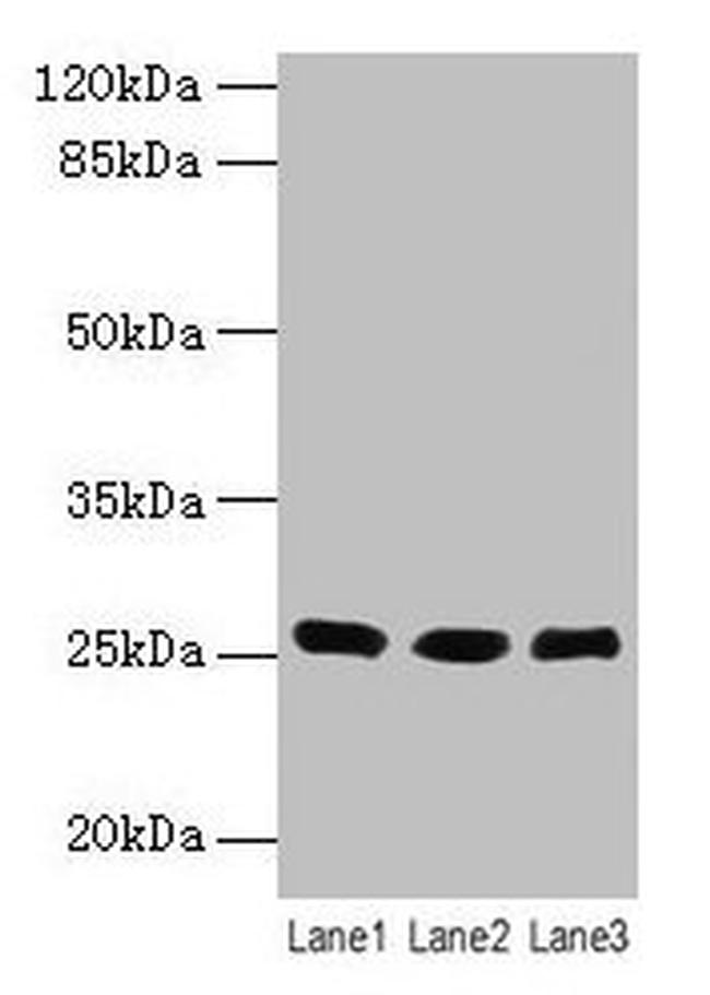 LIN7A Antibody in Western Blot (WB)