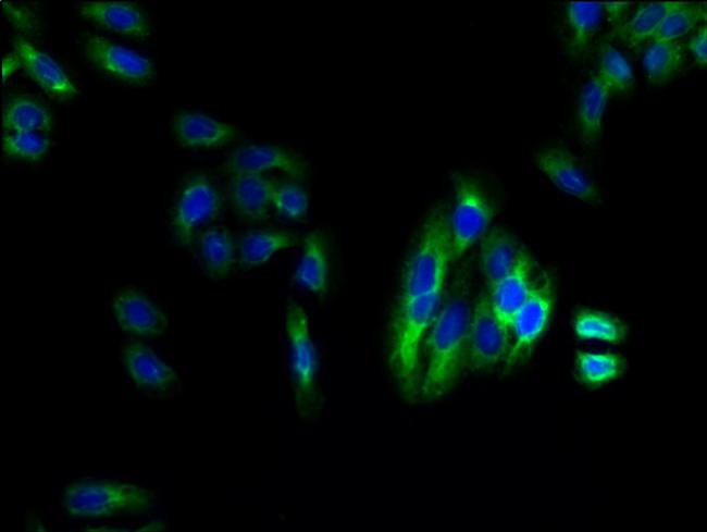 LPAR4 Antibody in Immunocytochemistry (ICC/IF)