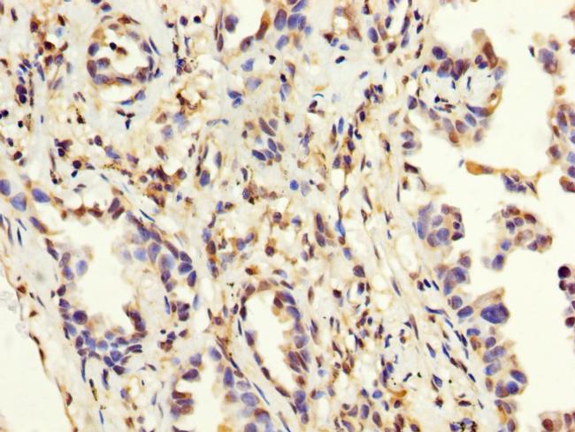 MAGEA3 Antibody in Immunohistochemistry (Paraffin) (IHC (P))