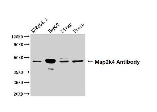 MAP2K4 Antibody in Western Blot (WB)