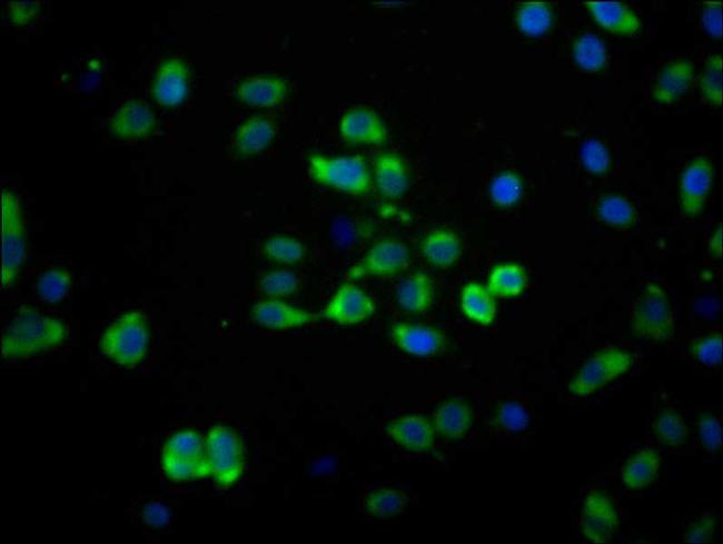 MAS1 Antibody in Immunocytochemistry (ICC/IF)