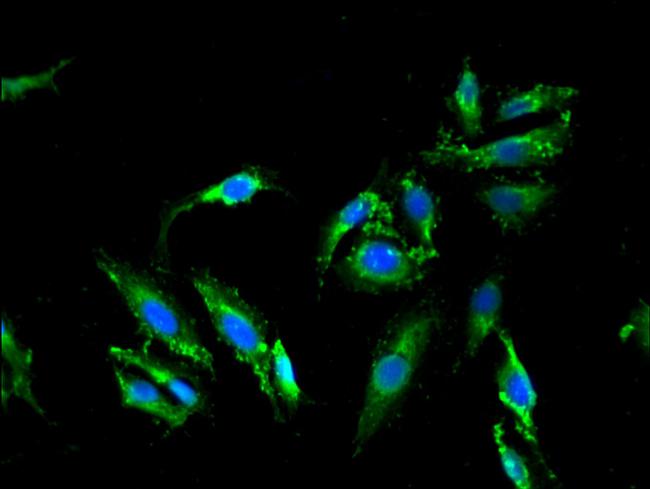 Melanophilin Antibody in Immunocytochemistry (ICC/IF)