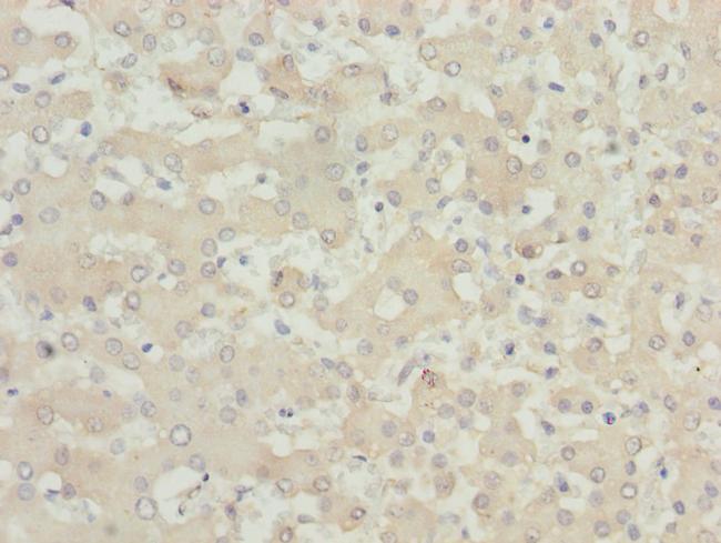 MOCS3 Antibody in Immunohistochemistry (Paraffin) (IHC (P))